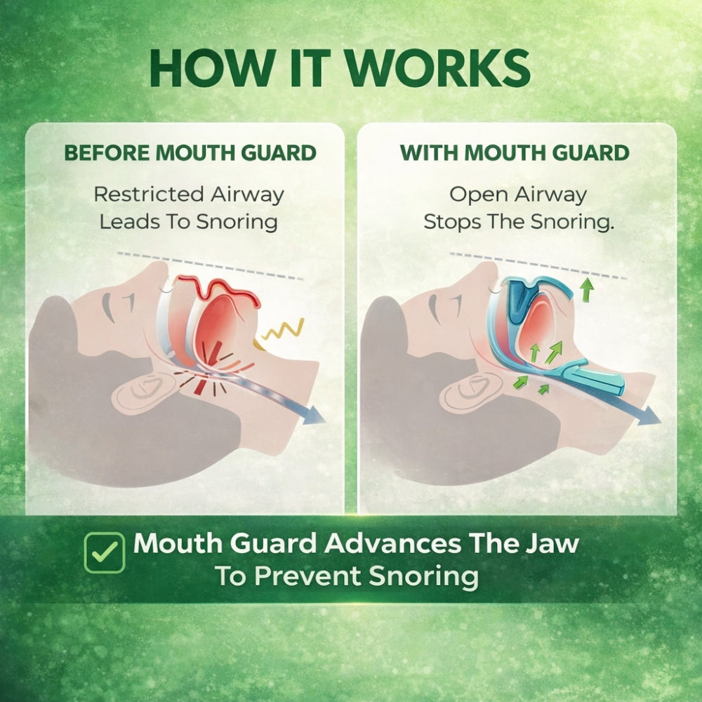 Exilerance™ Anti-Snoring Mouthpiece