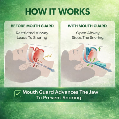 Exilerance™ Anti-Snoring Mouthpiece